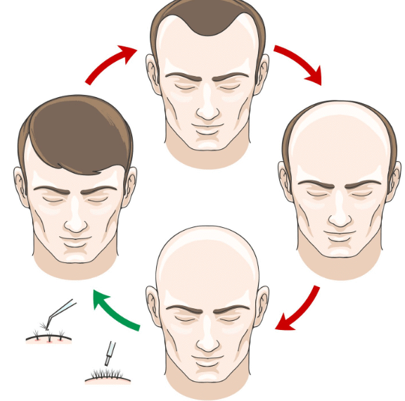 Modern Hair Restoration: Innovations Delivering Better Outcomes