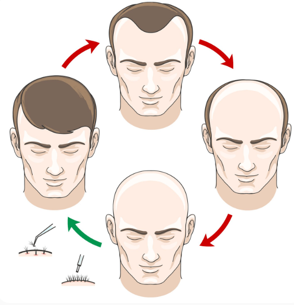 Modern Hair Restoration: Innovations Delivering Better Outcomes